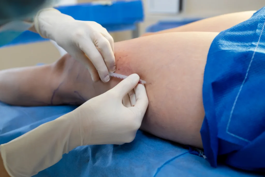 injection procedure on a leg in a medical setting